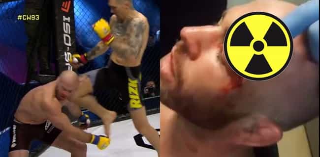 British MMA veteran suffers the most gruesome cut you’ll ever see