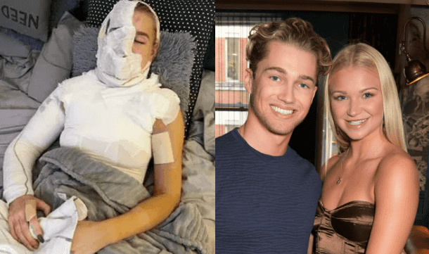 AJ Pritchard’s partner, Abbie Quinnen, pictured for first time since suffering third degree burns