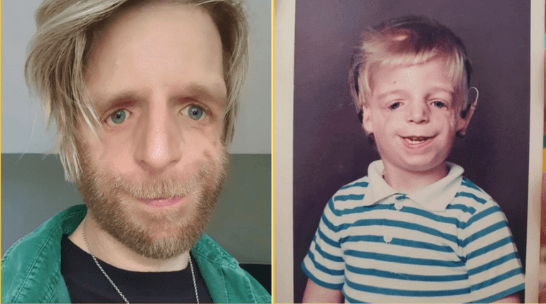 Man was abandoned at birth by parents because they didn’t like his face