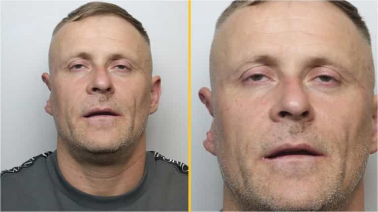 Police warn public not to approach man with half an ear