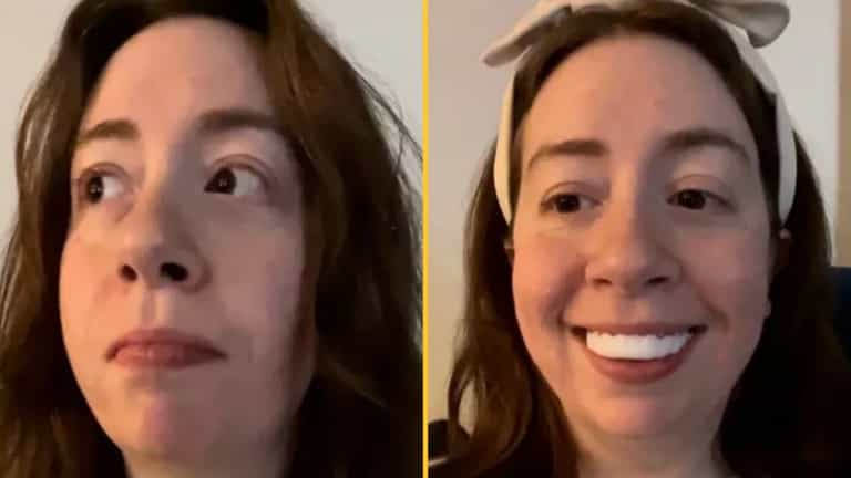 Woman horrified after applying clip-in veneers for her wedding