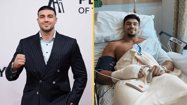 Tommy Fury hospitalised over ‘extreme pain’ that left him unable to fight with right hand