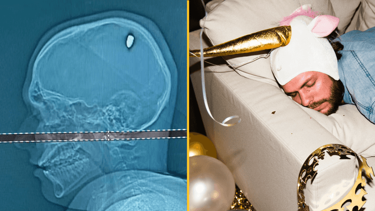 Man was on a bender for days before figuring out he’d been shot in the head