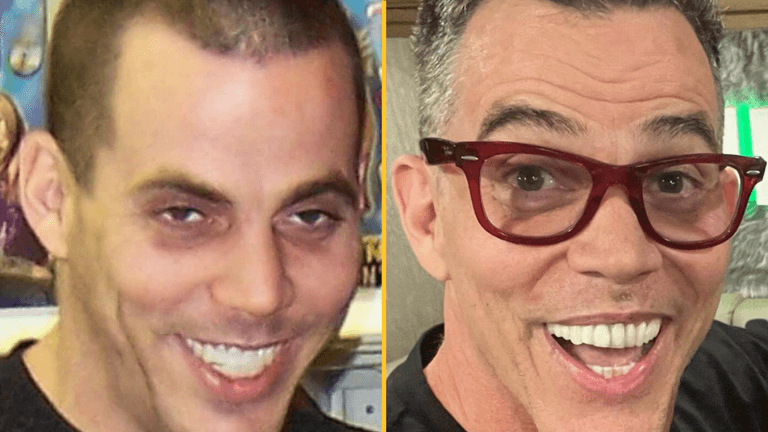 Steve-O shares incredible before-and-after pics to mark sobriety anniversary