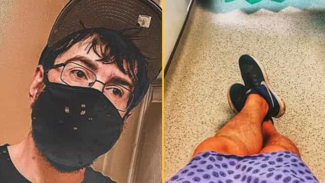 Man with ‘world’s smallest penis’ announces enlargement surgery after crowdfunding