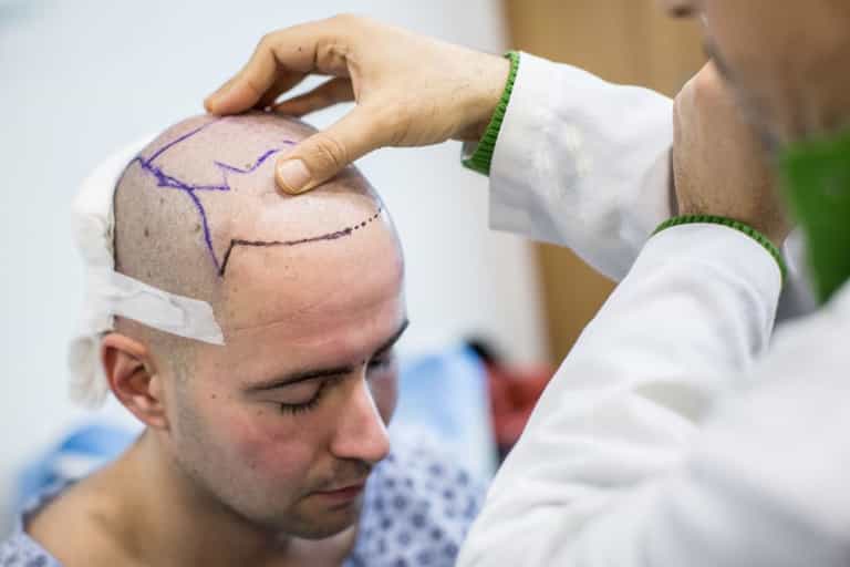 Scientists claim they can cure baldness