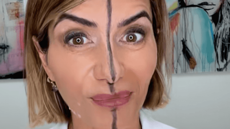 Doctor shares side effects of Botox after injecting only one side of her face