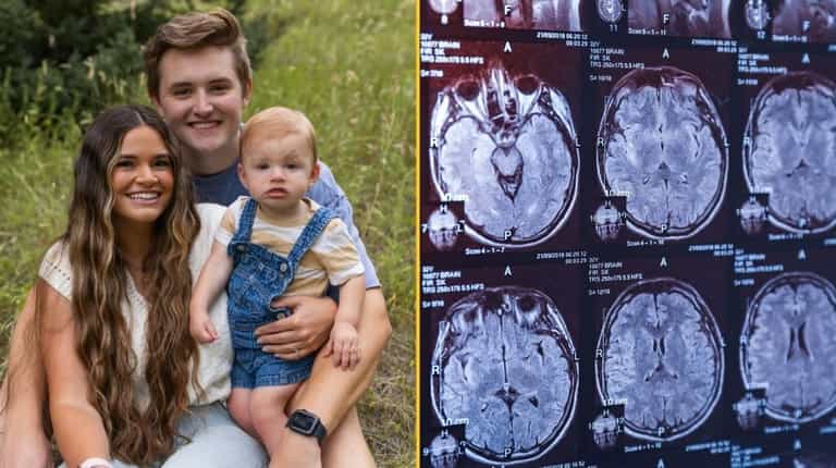 Woman marries man who forgot about their breakup after concussion