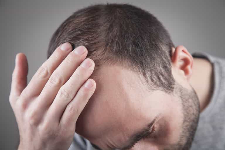 Male pattern baldness may soon be cured thanks to new drug