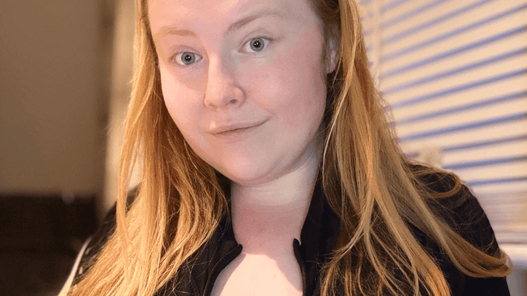 Woman with double N-cup boobs say they won’t stop growing due to rare condition