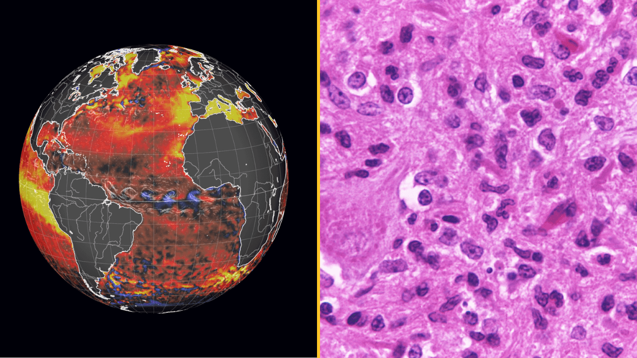 Super El Niño now comes with fatal rabies warning after ‘significant global shift’