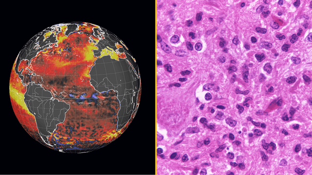 Super El Niño now comes with fatal rabies warning after ‘significant global shift’