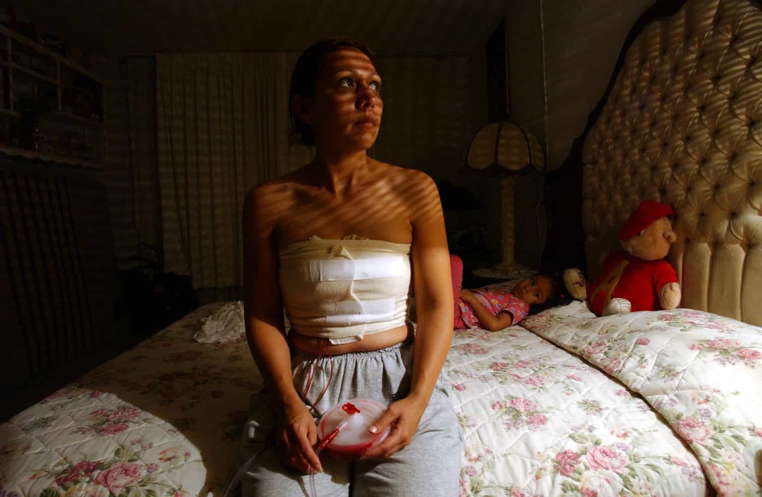 Twenty women had unnecessary mastectomies, County Durham NHS trust admits