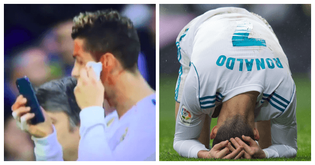 Cristiano Ronaldo uses phone as mirror to assess face injury, immediately walks off the pitch Cristiano Ronaldo uses phone as mirror to assess face injury, immediately walks off the pitch