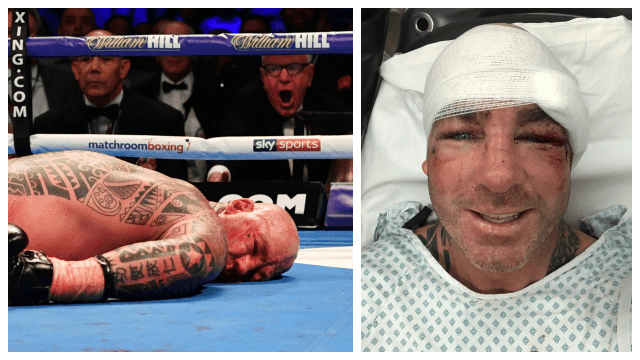 Lucas Browne posts recovery pics after brutal knockout from Dillian Whyte