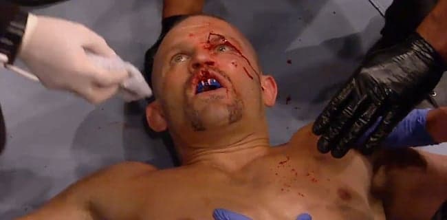Chuck Liddell dead serious about taking arguably the most inadvisable fight imaginable Chuck Liddell dead serious about taking arguably the most inadvisable fight imaginable
