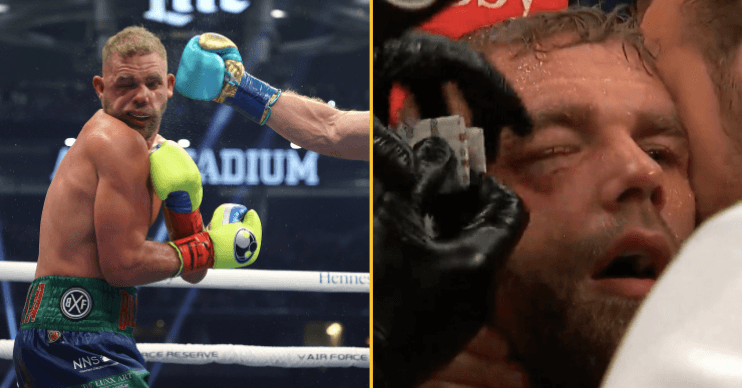 Eddie Hearn: Billy Joe Saunders will be out for a ‘long, long time’ after injuring eye Eddie Hearn: Billy Joe Saunders will be out for a ‘long, long time’ after injuring eye