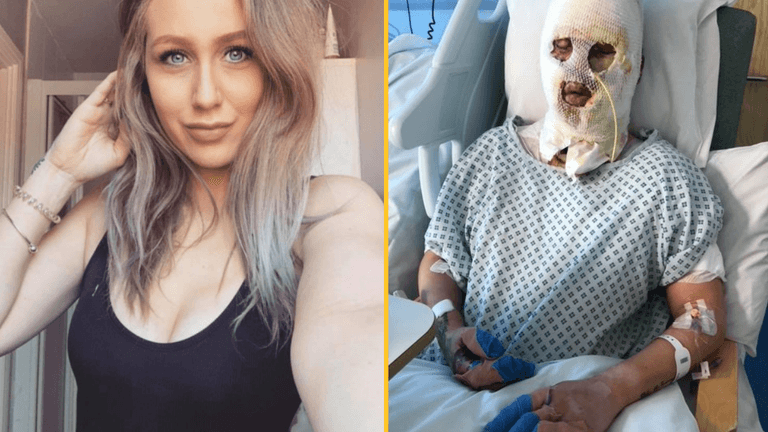 Mum burned by ethanol thrown on heater in beer garden said man ‘did it for a laugh’ Mum burned by ethanol thrown on heater in beer garden said man ‘did it for a laugh’