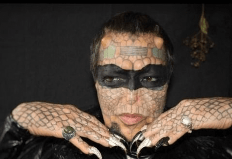 Former banker becomes ‘genderless reptile’ after castration procedure Former banker becomes ‘genderless reptile’ after castration procedure