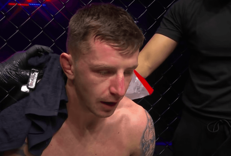 Cage fighter launched brutal hammer attack on thief who tried to raid his home Cage fighter launched brutal hammer attack on thief who tried to raid his home