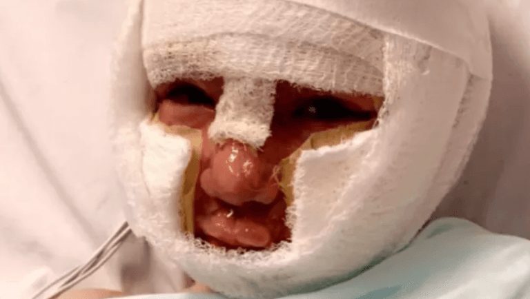 Schoolboy set on fire by bully with petrol soaked tennis ball ‘scarred for life’ Schoolboy set on fire by bully with petrol soaked tennis ball ‘scarred for life’