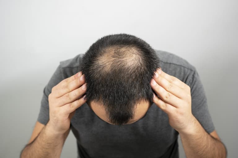 Great news for bald men as new drug successfully regrows hair in 40% of patients Great news for bald men as new drug successfully regrows hair in 40% of patients