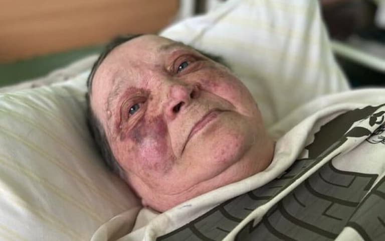 Woman, 70, ‘viciously beaten’ at Russian checkpoint after refusing to give up passport, Ukraine claims Woman, 70, ‘viciously beaten’ at Russian checkpoint after refusing to give up passport, Ukraine claims