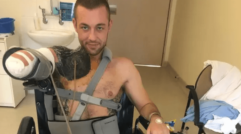 Man wakes up from coma to find he’s lost his arm after gym injury turned into ‘flesh eating’ infection Man wakes up from coma to find he’s lost his arm after gym injury turned into ‘flesh eating’ infection