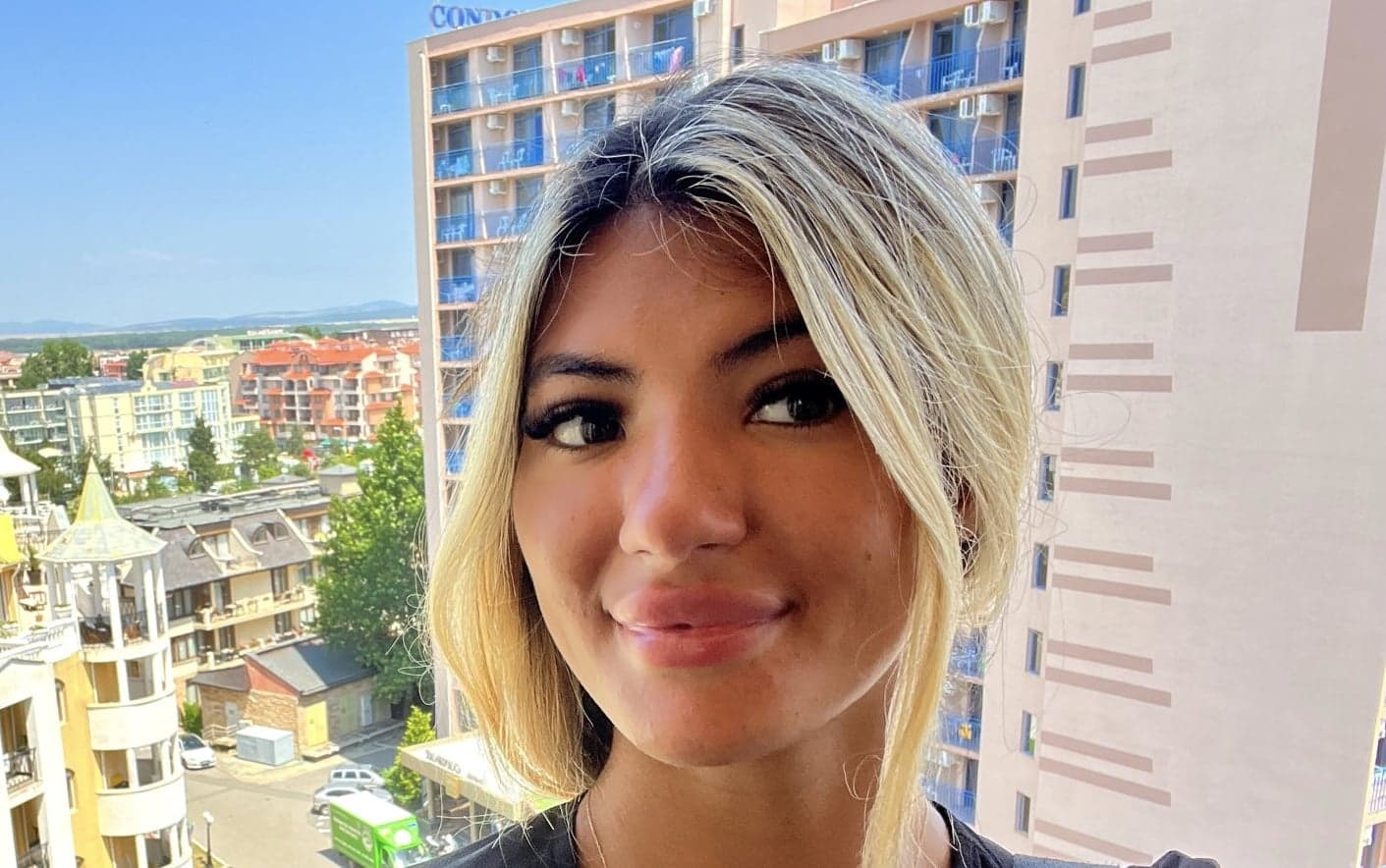 Woman ends up with ‘plastic’ forehead after falling asleep in the sun for 30 mins