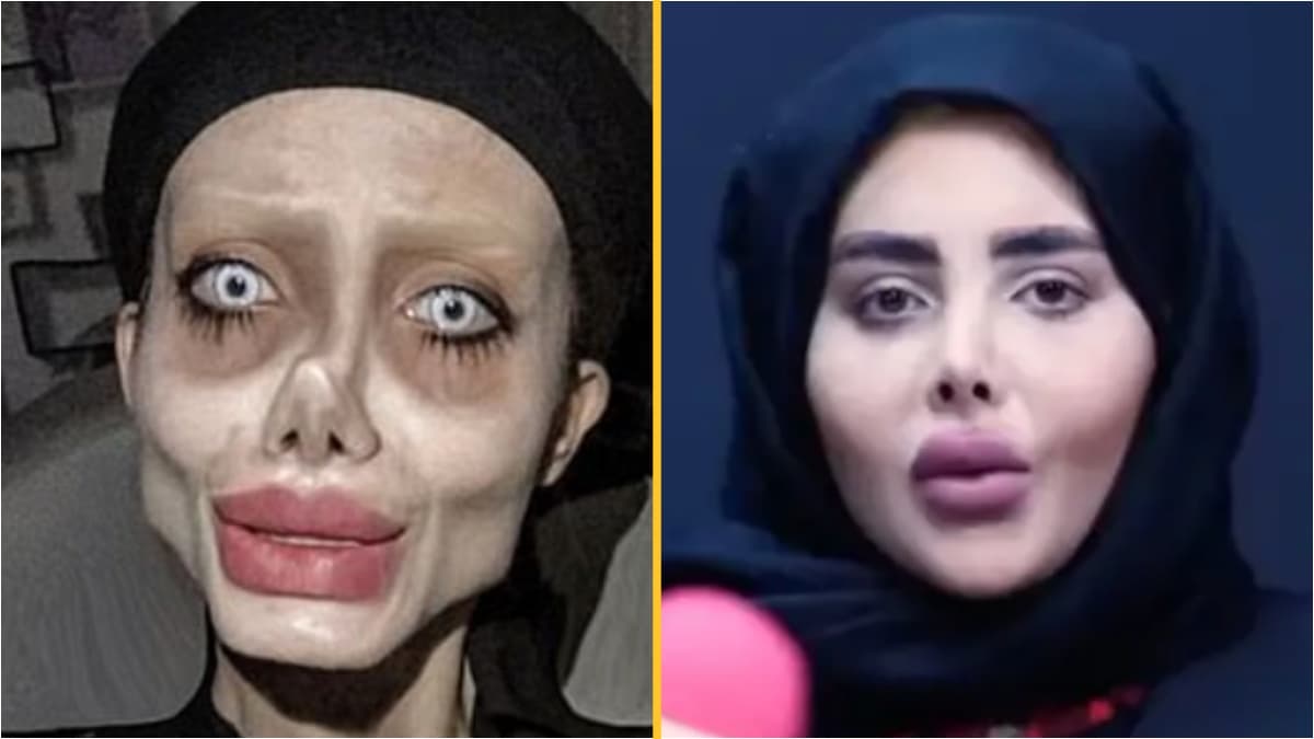 ‘Zombie’ Angelina Jolie lookalike shows real face in interview after release from prison