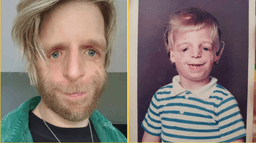 Man was abandoned at birth by parents because they didn’t like his face