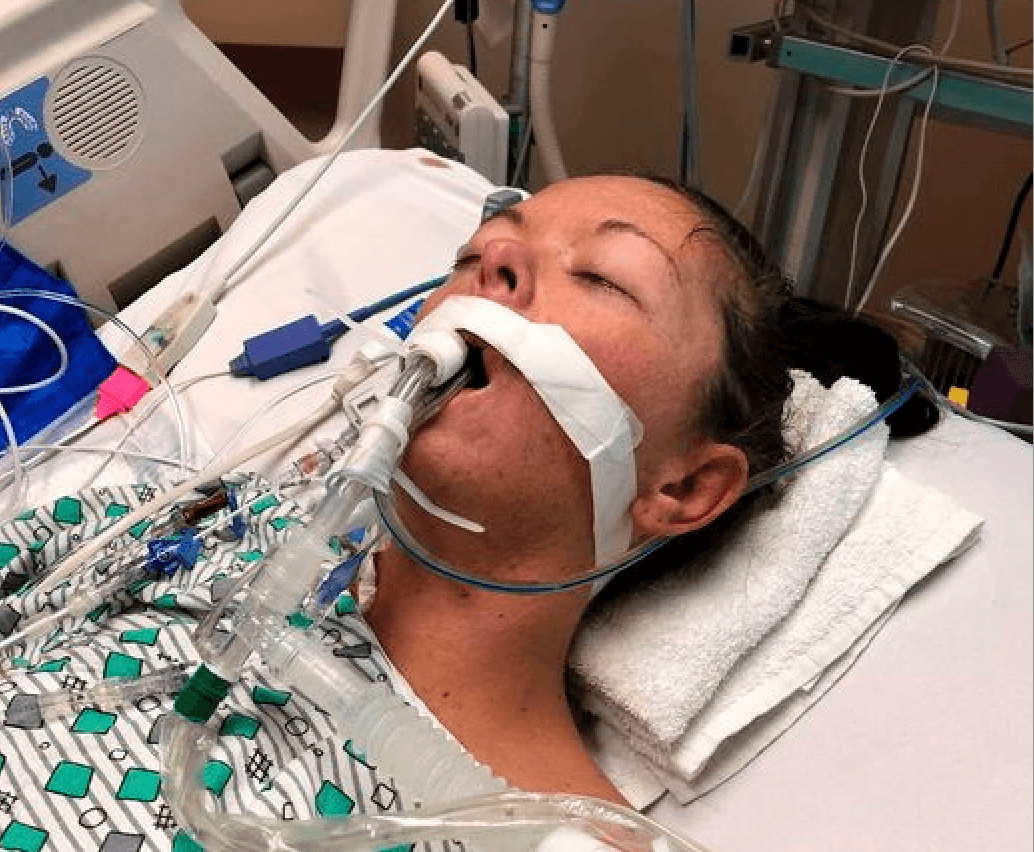 Vaping addict left on life support with deadly lung condition
