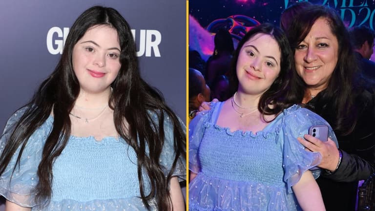 ‘Nurses said my parents should ‘leave me’ at the hospital – now I’m on the cover of Vogue’ ‘Nurses said my parents should ‘leave me’ at the hospital – now I’m on the cover of Vogue’