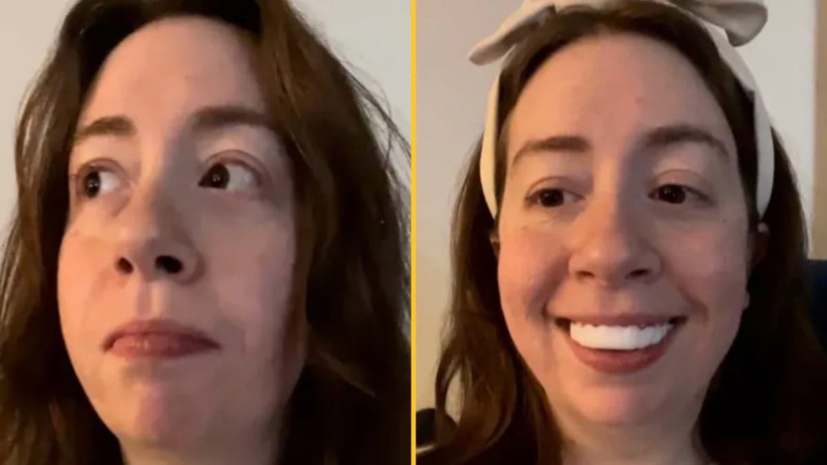 Woman horrified after applying clip-in veneers for her wedding