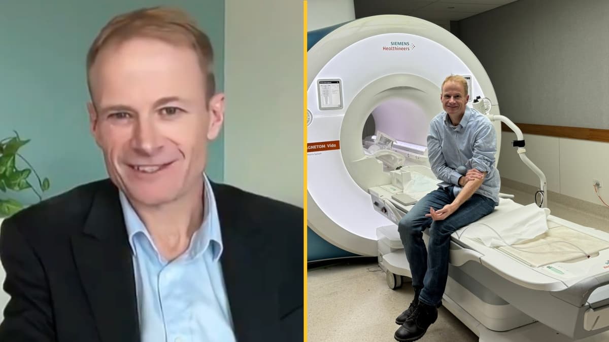 Doctor remains cancer-free one year after using treament he developed for terminal brain tumor