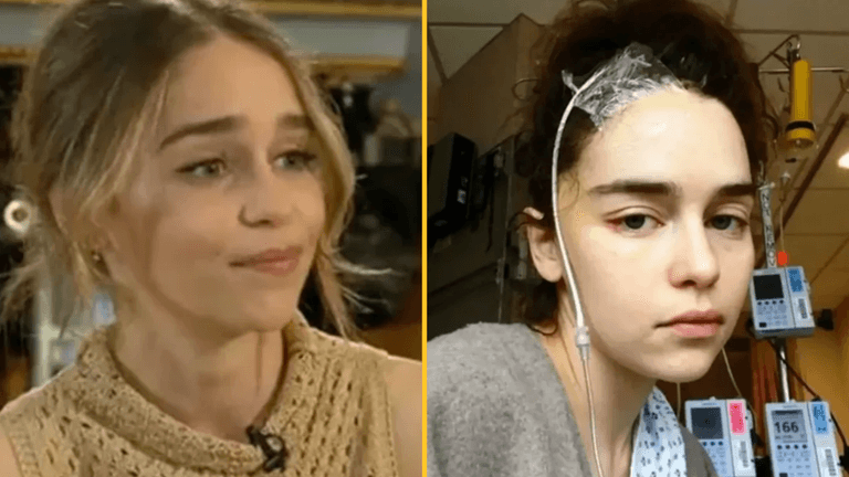 Emilia Clarke missing ‘quite a bit’ of her brain after two aneurysms and is ‘surprised’ she can speak