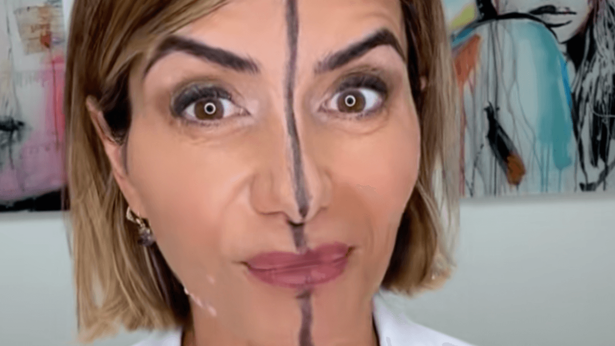 Doctor shares side effects of Botox after injecting only one side of her face