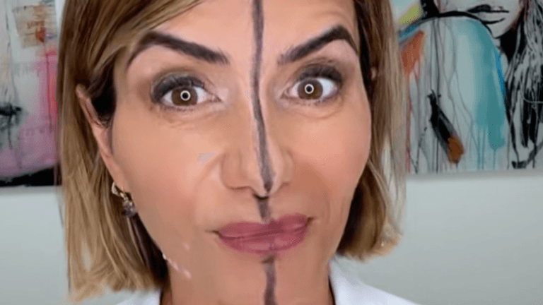 Doctor shares side effects of Botox after injecting only one side of her face