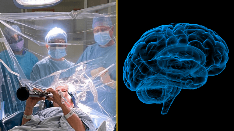 Woman plays clarinet for four hours while undergoing brain surgery for Parkinson’s disease