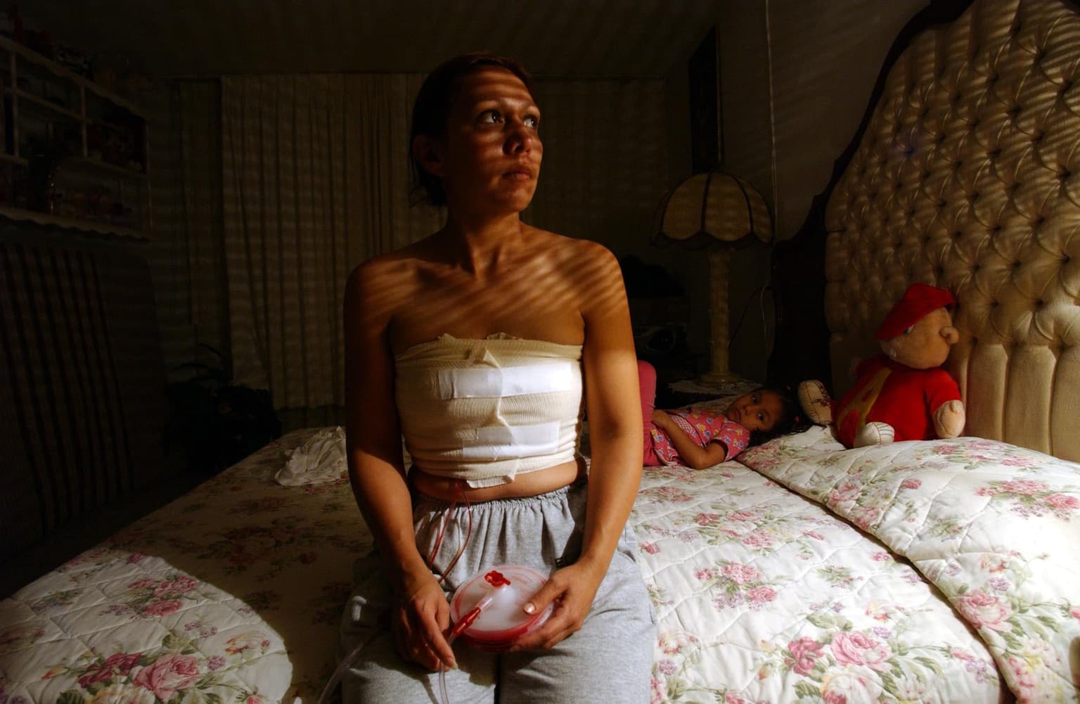 Twenty women had unnecessary mastectomies, County Durham NHS trust admits