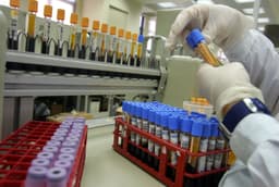 UK health officials issue plague risk update following Russian lab death