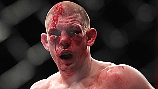 MMA corners could learn a lot from Joe Lauzon’s this weekend MMA corners could learn a lot from Joe Lauzon’s this weekend