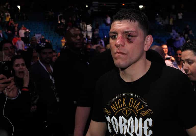 Nick Diaz’s mugshot released after assault arrest Nick Diaz’s mugshot released after assault arrest