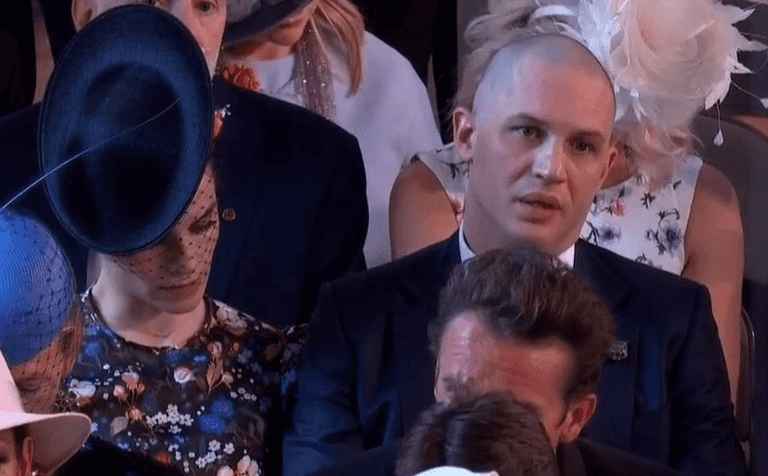 Tom Hardy turned up bald to the royal wedding and you can imagine the response Tom Hardy turned up bald to the royal wedding and you can imagine the response