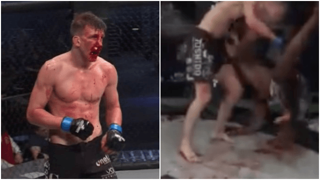 Shattered nose causes fighters to slip on blood in gruesome title fight Shattered nose causes fighters to slip on blood in gruesome title fight