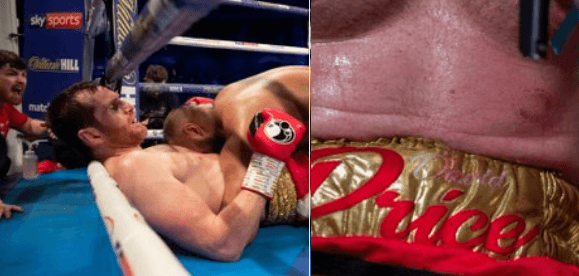 Boxer disqualified for biting David Price in bizarre heavyweight bout Boxer disqualified for biting David Price in bizarre heavyweight bout
