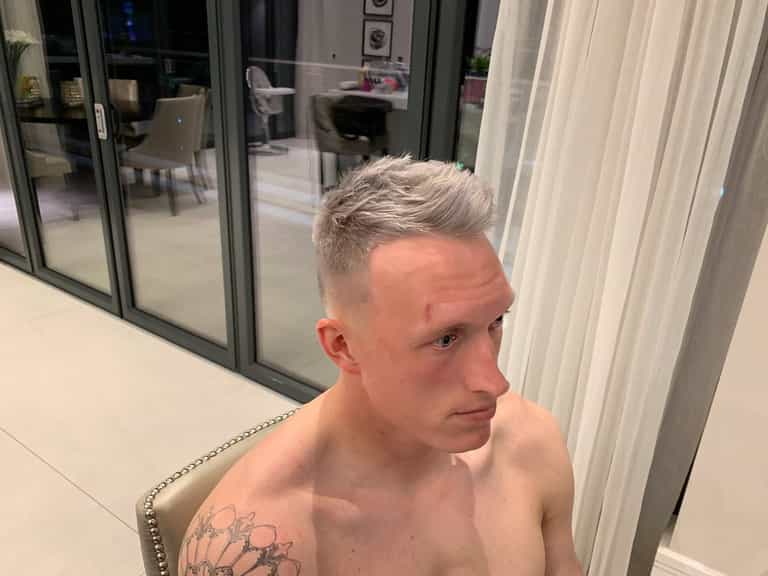 Phil Jones has grey hair now and it is spectacular Phil Jones has grey hair now and it is spectacular