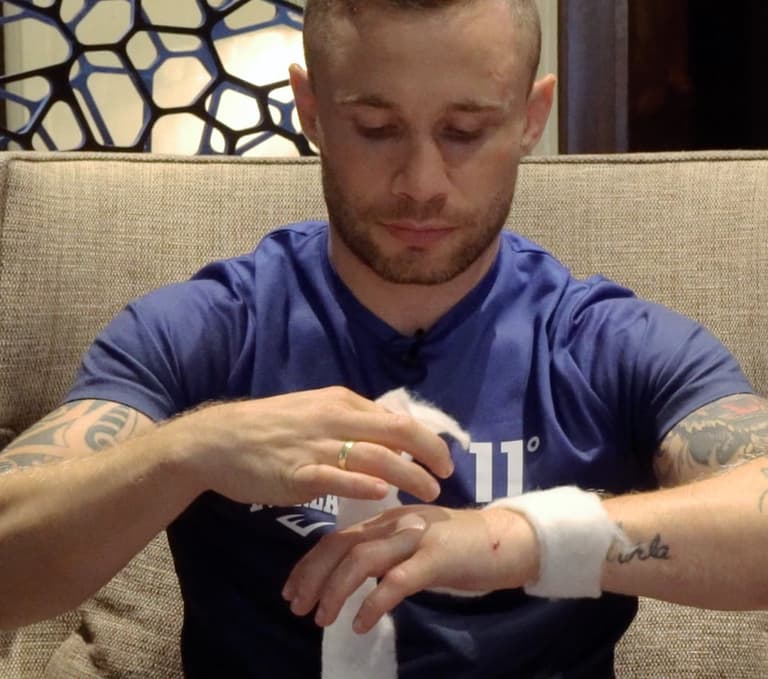 Carl Frampton won’t let freak injury stop his world title fight dream Carl Frampton won’t let freak injury stop his world title fight dream