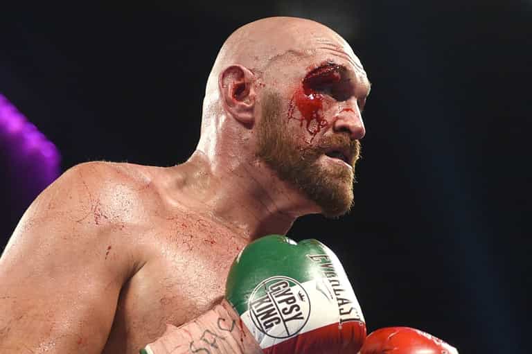 Tyson Fury’s cut against Otto Wallin a wake up call ahead of Wilder rematch Tyson Fury’s cut against Otto Wallin a wake up call ahead of Wilder rematch