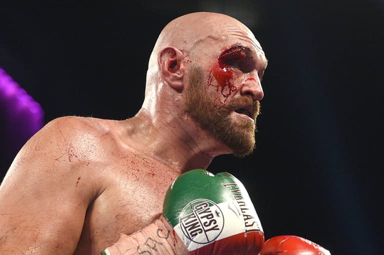 Tyson Fury’s cut against Otto Wallin a wake up call ahead of Wilder rematch Tyson Fury’s cut against Otto Wallin a wake up call ahead of Wilder rematch